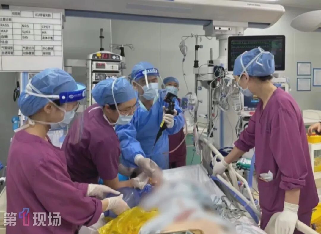 21岁女子漂流呛水后吐血不止!一查肺部竟有个“定时炸弹”!ECMO+手术抢回一命 21岁女子漂流呛水后吐血不止!一查肺部竟有个“定时炸弹”!ECMO+手术抢回一命