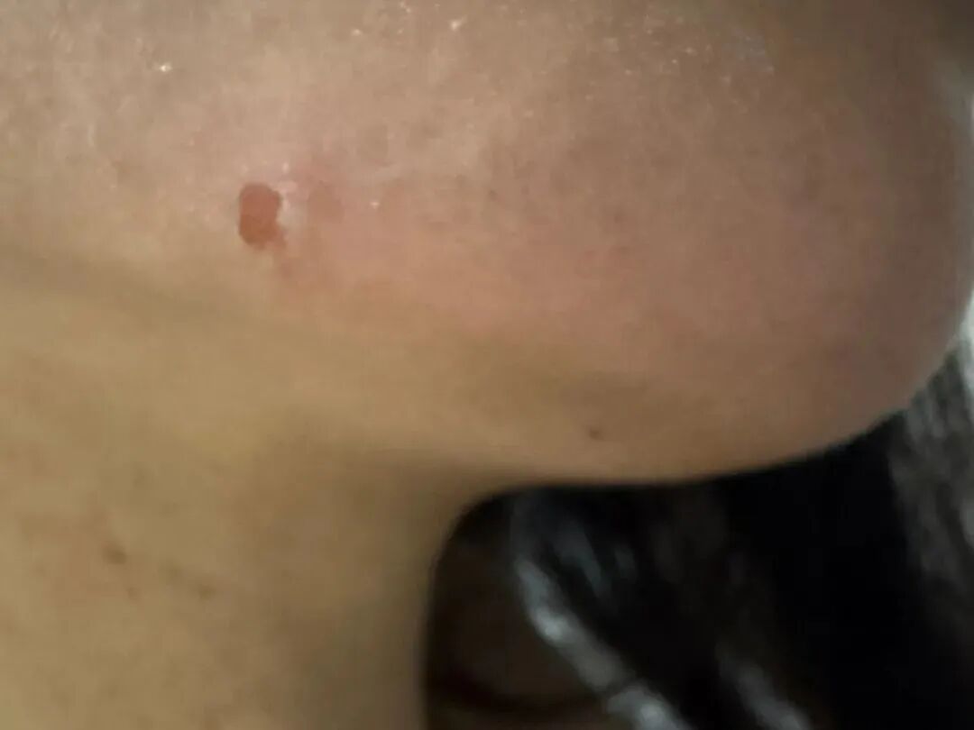 燃烧后可达800℃！男子走路吸烟，手中烟头烫伤过路孩子面部…