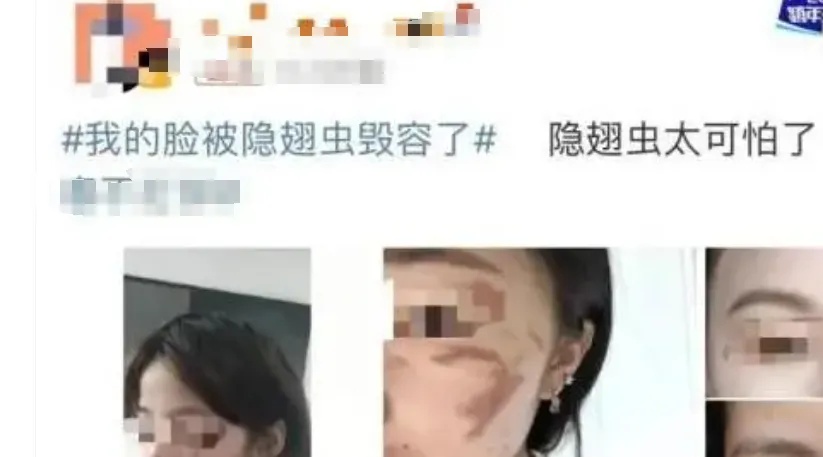 不要拍!不要打!浙江姑娘痛到失眠,不少人直呼“已中招”,最新提醒 不要拍!不要打!浙江姑娘痛到失眠,不少人直呼“已中招”,最新提醒
