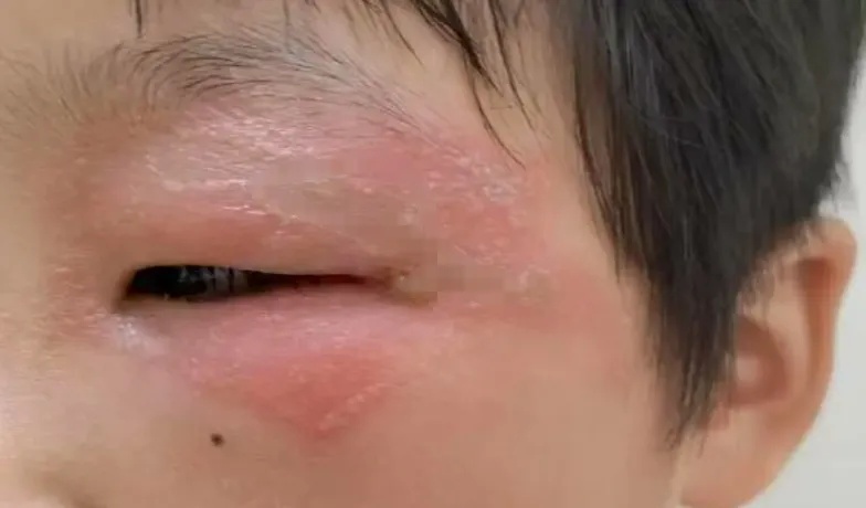 不要拍!不要打!浙江姑娘痛到失眠,不少人直呼“已中招”,最新提醒 不要拍!不要打!浙江姑娘痛到失眠,不少人直呼“已中招”,最新提醒