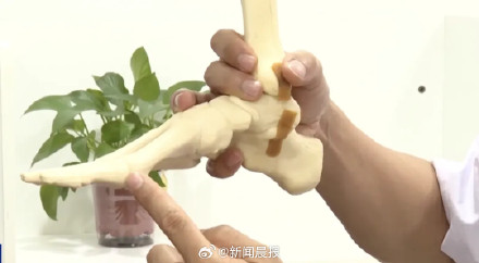 长期穿洞洞鞋或引发足部疾病:可能阻碍足弓发育,增加真菌感染风险! 长期穿洞洞鞋或引发足部疾病:可能阻碍足弓发育,增加真菌感染风险!