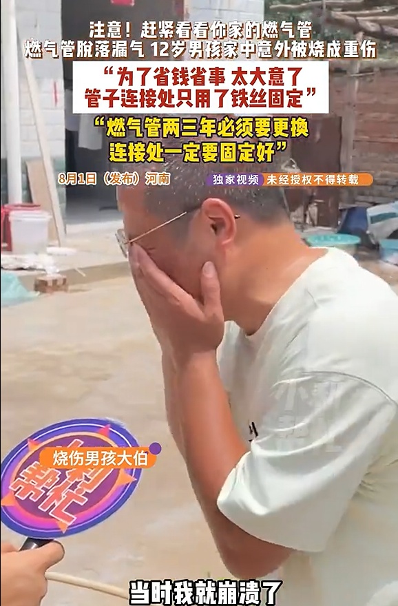 12岁男孩全身90%烧伤!一根铁丝酿剧,赶紧自查家中这个隐患 12岁男孩全身90%烧伤!一根铁丝酿剧,赶紧自查家中这个隐患