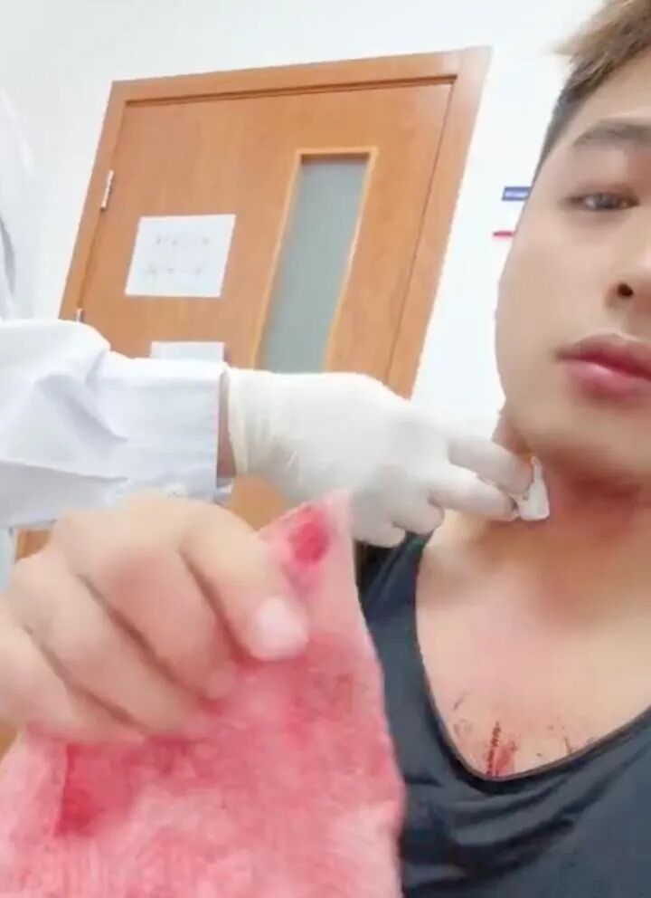 男子被蚊子叮咬颈部 抓挠后血流不止 当事人发声:朋友都以为我跟人打架了 男子被蚊子叮咬颈部 抓挠后血流不止 当事人发声:朋友都以为我跟人打架了