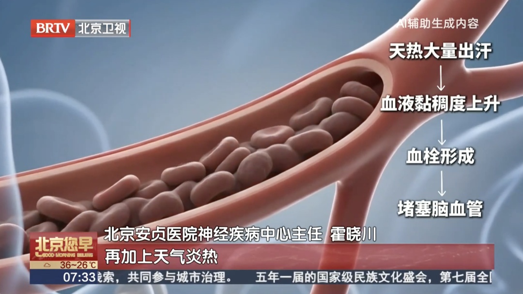 气温一旦超过这个数,“热中风”风险飙升48%!很多人却当成中暑硬扛 气温一旦超过这个数,“热中风”风险飙升48%!很多人却当成中暑硬扛