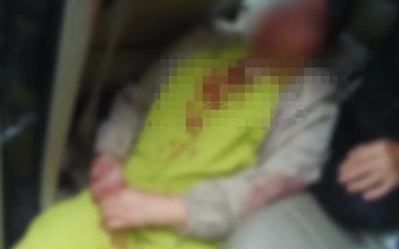 后排乘客头部受猛烈撞击、颈椎骨折，经抢救无效不幸身亡！重要提醒→