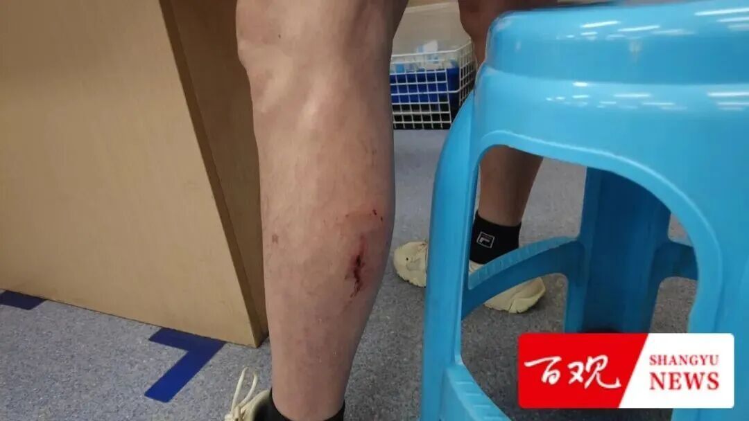 致死率近乎100%!杭州人注意,已进入全年高发时段 致死率近乎100%!杭州人注意,已进入全年高发时段