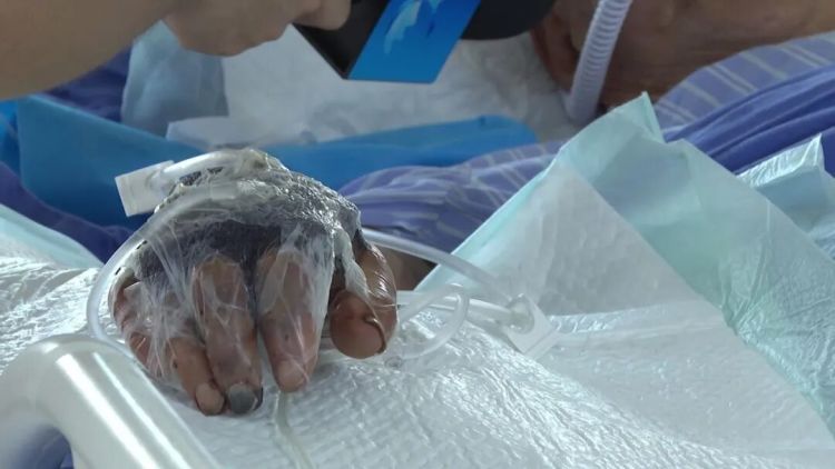戴手套！戴手套！厦门一男子感染住进ICU！医生紧急提醒