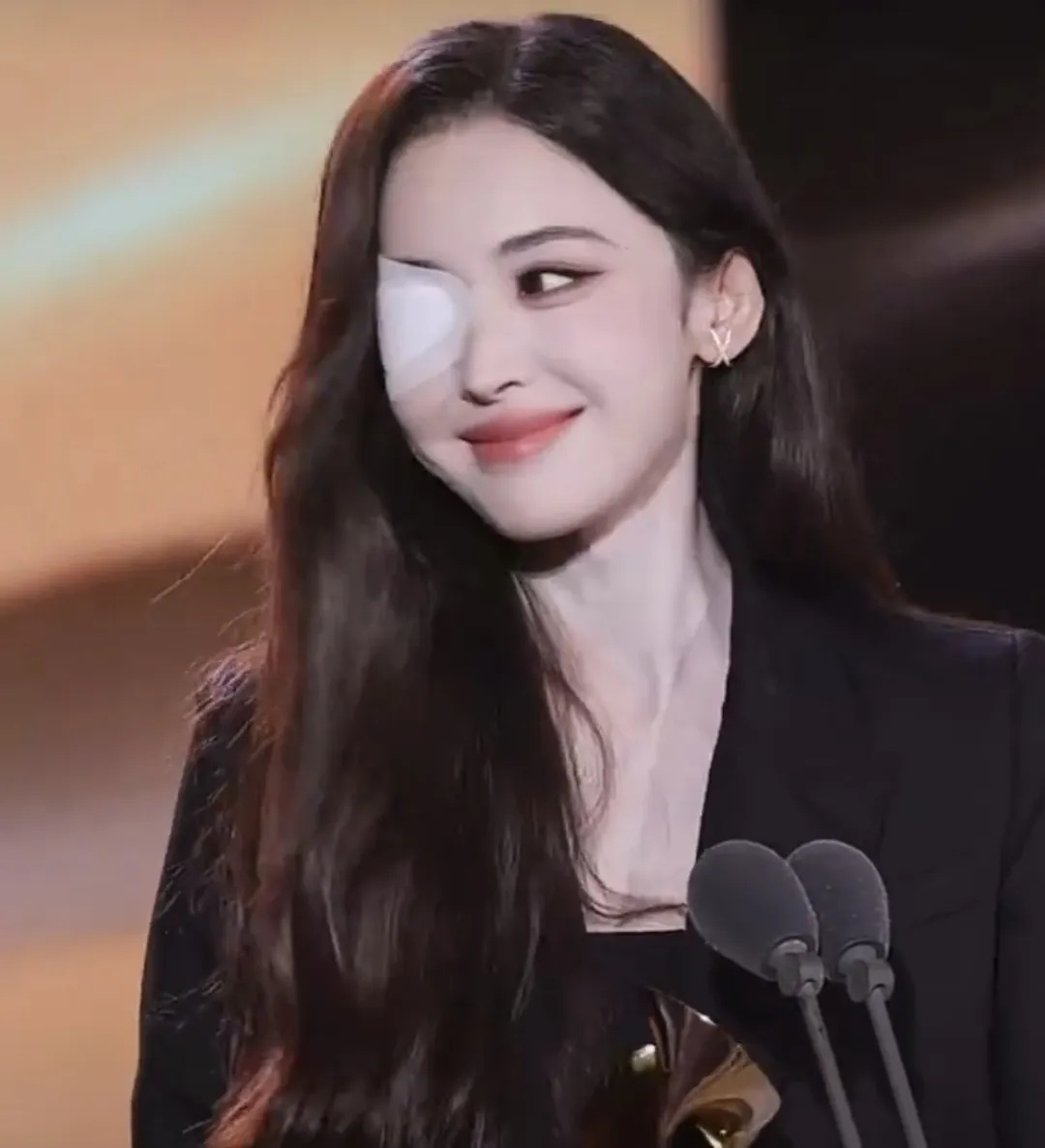 演员娜扎谈眼睛病情：恢复情况不不太妙，或将手术，可能是小时候留下的病根