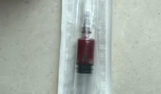 浙江男子腹痛在家硬扛两天,差点丢了命!医生:这9种腹痛耽误不得 浙江男子腹痛在家硬扛两天,差点丢了命!医生:这9种腹痛耽误不得