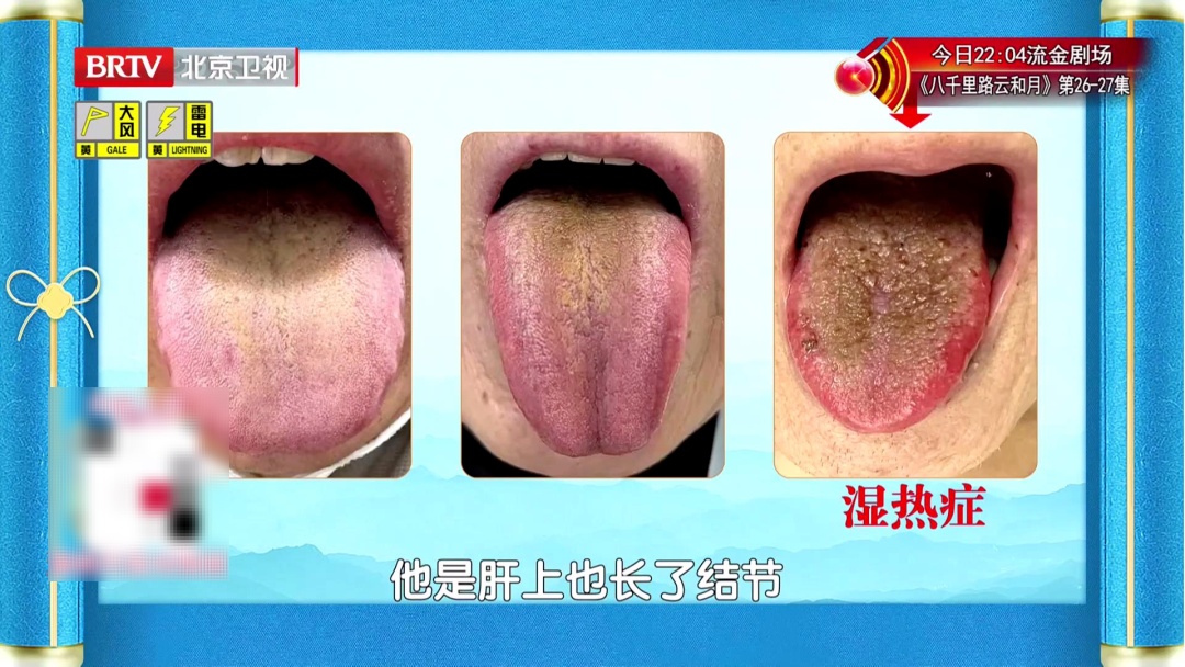 别忽视,身体出现这些异常,或是肝脏发出的预警信号,坏习惯抓紧改 别忽视,身体出现这些异常,或是肝脏发出的预警信号,坏习惯抓紧改