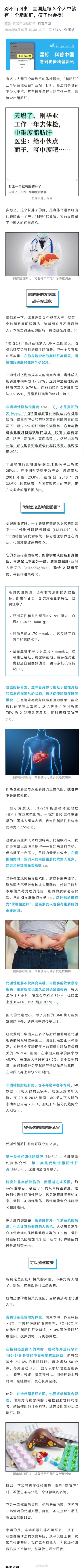 全国每3个人中就有1个脂肪肝 全国每3个人中就有1个脂肪肝