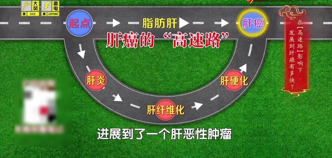别忽视,身体出现这些异常,或是肝脏发出的预警信号,坏习惯抓紧改 别忽视,身体出现这些异常,或是肝脏发出的预警信号,坏习惯抓紧改