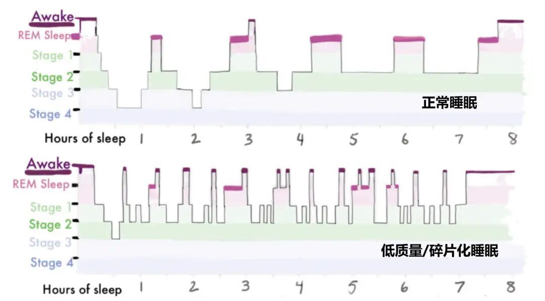 睡够8小时还是巨累！多半是因为这一个字