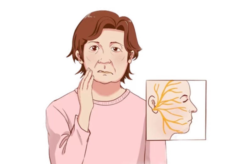 杭州大姐一觉醒来，半边脸“不听使唤”了！医生：这个病越早治越好