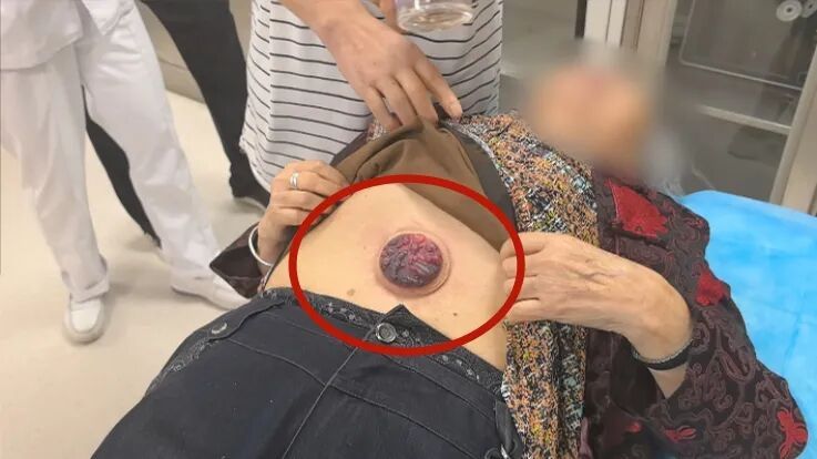 想在家拔火罐?看完这篇再决定 想在家拔火罐?看完这篇再决定