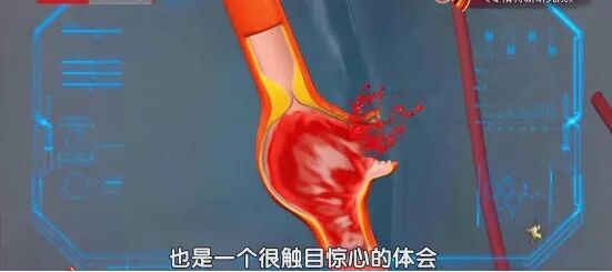 连喝3天绿豆汤,突发脑出血,医生:这4类情况再喜欢也要少碰 连喝3天绿豆汤,突发脑出血,医生:这4类情况再喜欢也要少碰