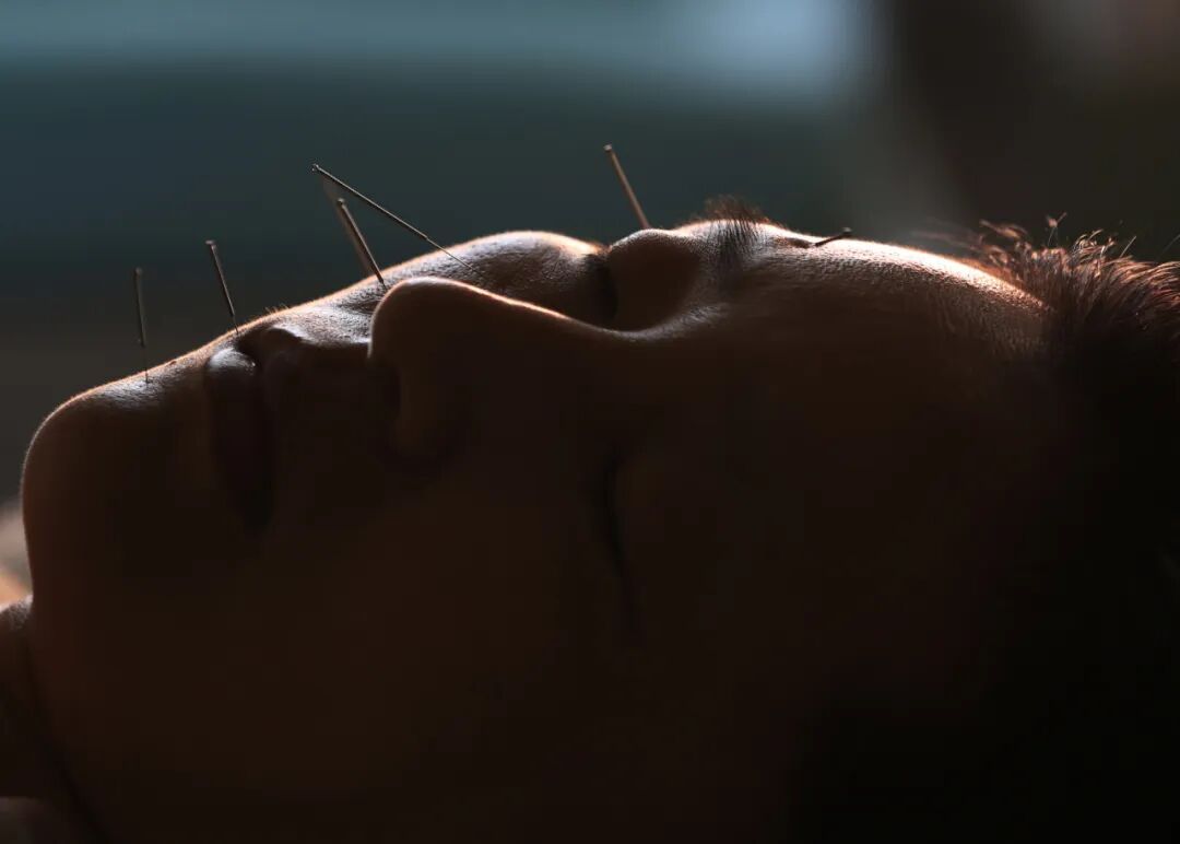 杭州大姐一觉醒来，半边脸“不听使唤”了！医生：这个病越早治越好