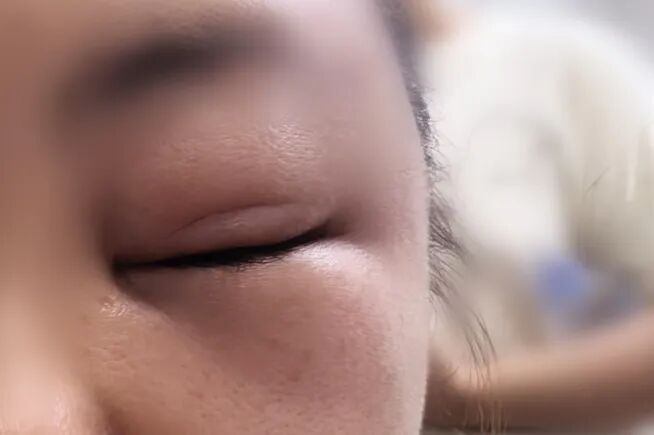 "差点要我命了！"女子在阳台上遭突袭，5分钟不到呼吸困难！近期务必小心