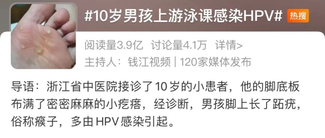 浙江10岁孩子游泳后，脚底长满“菜花”，确诊HPV感染！紧急提醒
