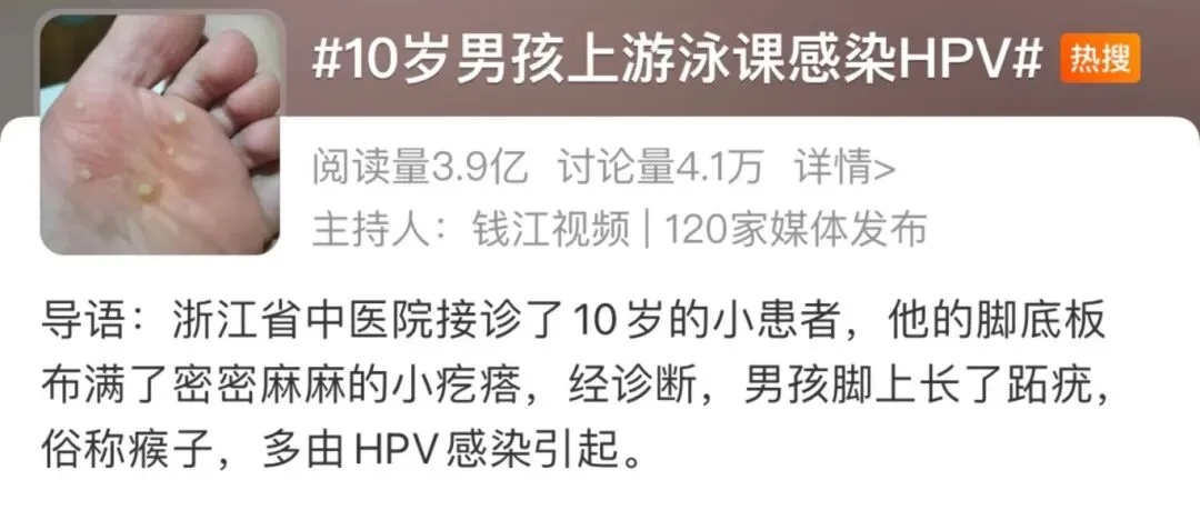 10岁孩子游泳后脚底长满小疙瘩，确诊感染HPV，医生提醒：这些细节要当心→