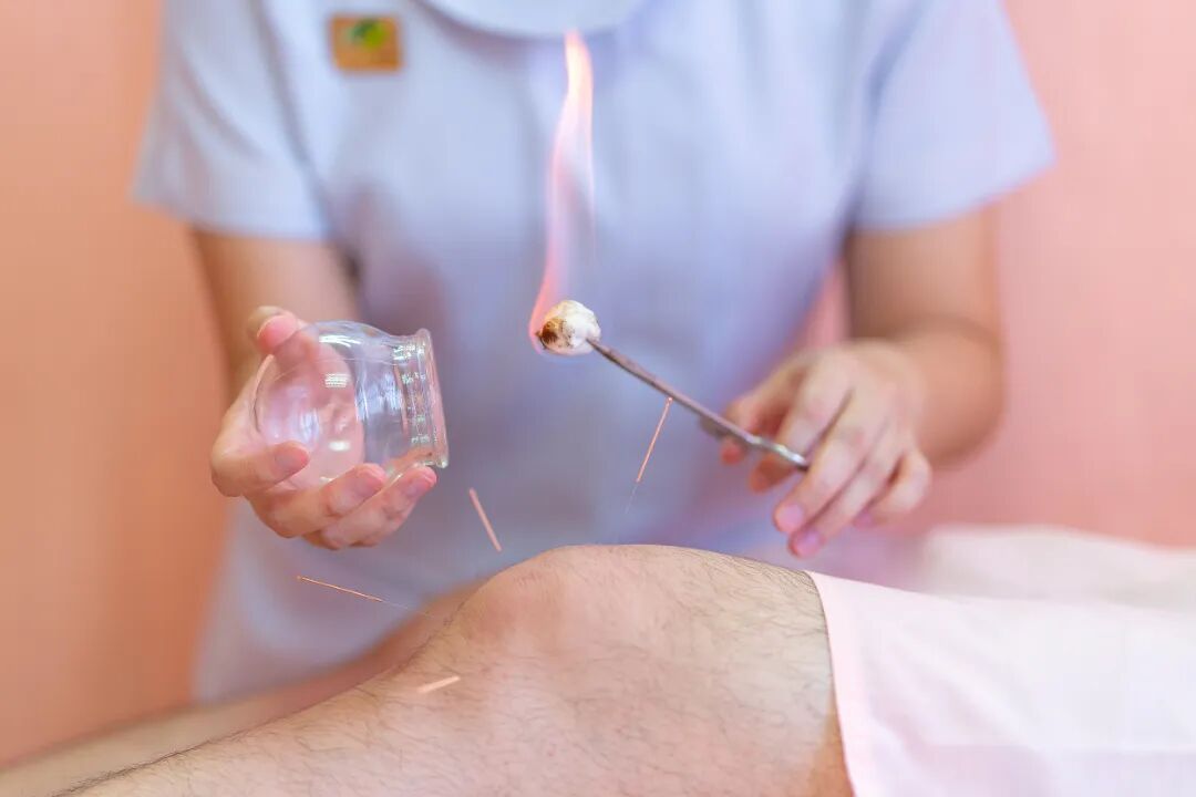 隔着屏幕都疼！有人拔火罐时肚子被死“咬”住！医生找消防帮忙…
