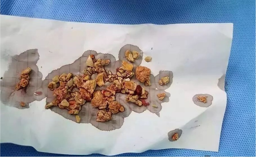 每天该喝多少水?不同年龄标准来了→ 每天该喝多少水?不同年龄标准来了→