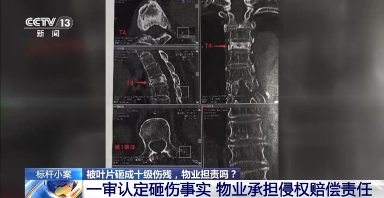 老人小区内遛弯被大王椰叶片砸成十级伤残 物业要担责吗？