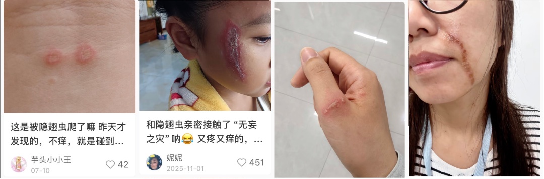 北京已有人中招，千万不能拍，毒液堪比硫酸，会毁容——