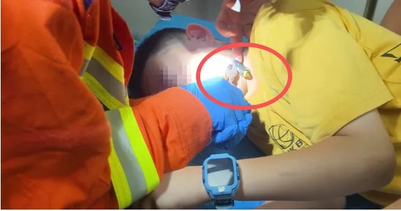 危险!12岁男孩湖边玩耍,被它一口“咬”脸...... 危险!12岁男孩湖边玩耍,被它一口“咬”脸......