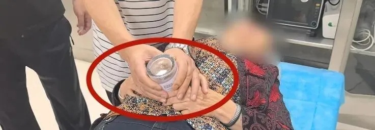 老人肚子被“咬”数小时！想在家拔火罐？看完这篇再决定