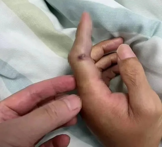 “开渔季”到了!这份健康尝“鲜”指南快收藏! “开渔季”到了!这份健康尝“鲜”指南快收藏!