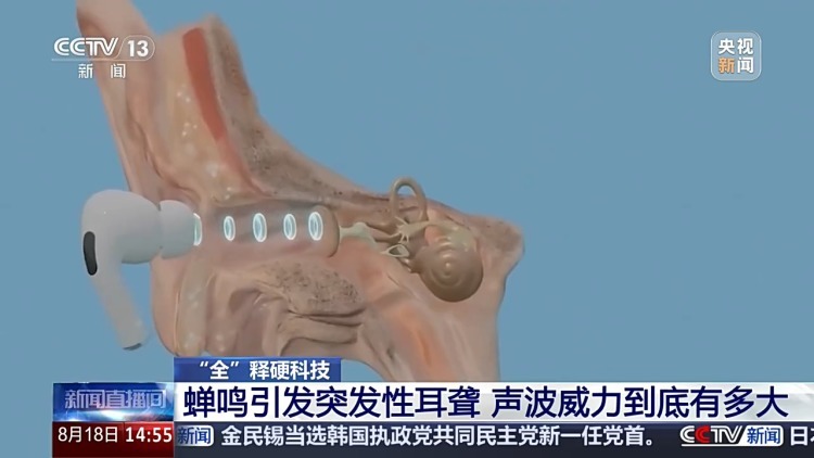 蝉鸣引发突发性耳聋 声波威力到底有多大? 蝉鸣引发突发性耳聋 声波威力到底有多大?