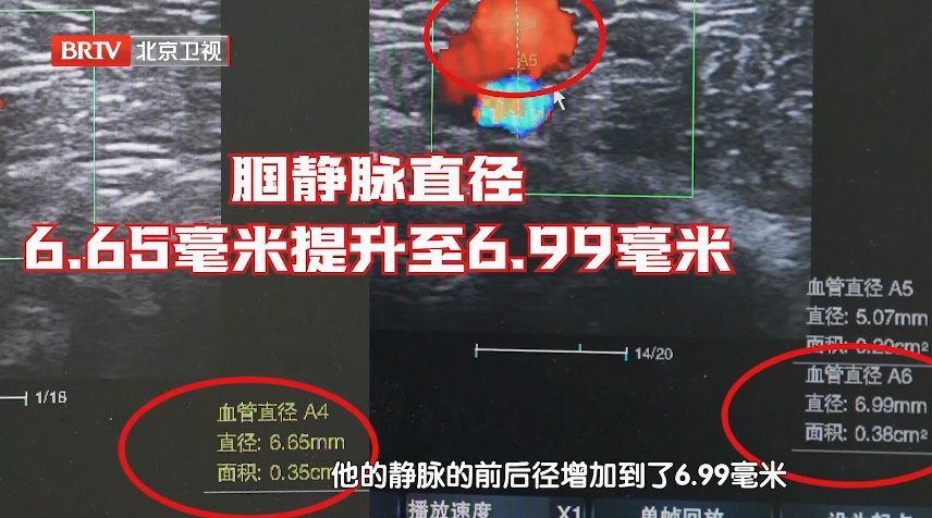 体检单中藏着“心梗指标”,没箭头可能也危险,这8个部位痛过的,要警惕 体检单中藏着“心梗指标”,没箭头可能也危险,这8个部位痛过的,要警惕