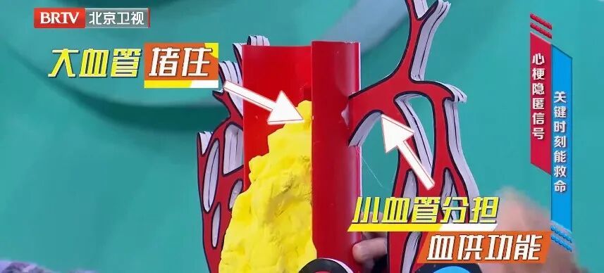 体检单中藏着“心梗指标”,没箭头可能也危险,这8个部位痛过的,要警惕 体检单中藏着“心梗指标”,没箭头可能也危险,这8个部位痛过的,要警惕