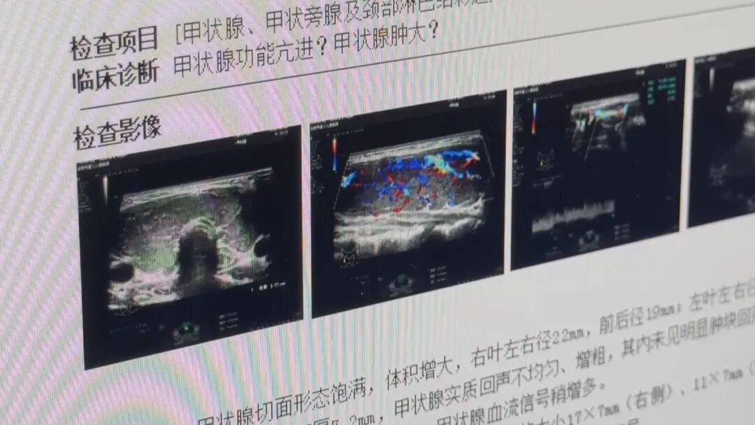 12岁“乖乖女”突然暴躁易怒、性格反常！医生：不是青春期叛逆，是身体在“报警”