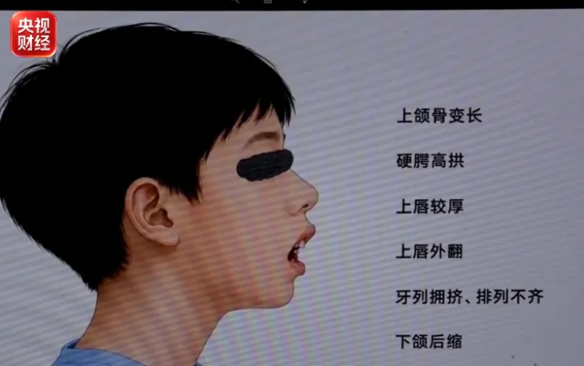 打呼噜是睡得香?小心影响孩子身高智力 打呼噜是睡得香?小心影响孩子身高智力