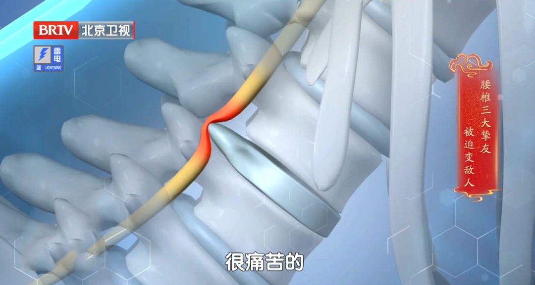 巨毁腰的2个锻炼动作,骨科医生劝你赶紧停,很多人第一个就中招 巨毁腰的2个锻炼动作,骨科医生劝你赶紧停,很多人第一个就中招