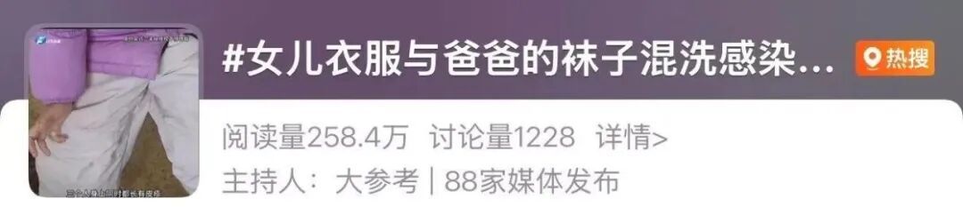 全家衣物混洗致8岁娃“中招”花斑癣!科学洗衣注意这几点 全家衣物混洗致8岁娃“中招”花斑癣!科学洗衣注意这几点