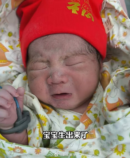 浙江义乌一62岁女子顺利诞下6斤重男婴，医生：从来没有碰到过