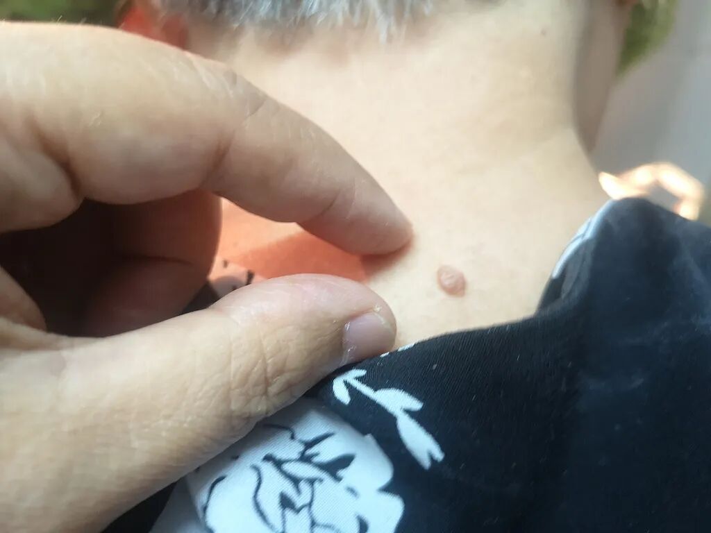 女子直呼天塌了!这个小习惯竟导致感染!奇痒难受!“明明很注意卫生…” 女子直呼天塌了!这个小习惯竟导致感染!奇痒难受!“明明很注意卫生…”