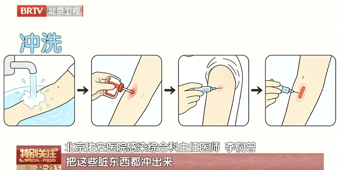 近期高发！专家提醒：千万别摸，接触就是狂犬病三级暴露！