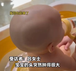 宝宝餐椅跌落头骨骨折,老人瞒三天不敢说!带娃的“锅”,到底该谁来背? 宝宝餐椅跌落头骨骨折,老人瞒三天不敢说!带娃的“锅”,到底该谁来背?
