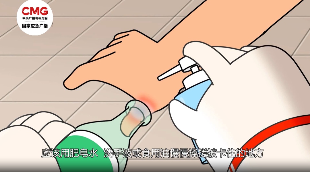 厨房里的这个小洞，千万别用手指去试探！已有人“中招”