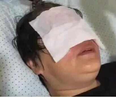 4岁男孩把打火机扔进热水壶!外婆被"炸"进医院,惨遭"毁容" 4岁男孩把打火机扔进热水壶!外婆被"炸"进医院,惨遭"毁容"