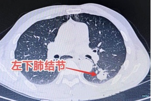 体内有癌,嗓子先知?出现这几个信号别当感冒拖上海瑞金医院:癌细胞或已存在 体内有癌,嗓子先知?出现这几个信号别当感冒拖上海瑞金医院:癌细胞或已存在