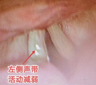 体内有癌,嗓子先知?出现这几个信号别当感冒拖上海瑞金医院:癌细胞或已存在 体内有癌,嗓子先知?出现这几个信号别当感冒拖上海瑞金医院:癌细胞或已存在