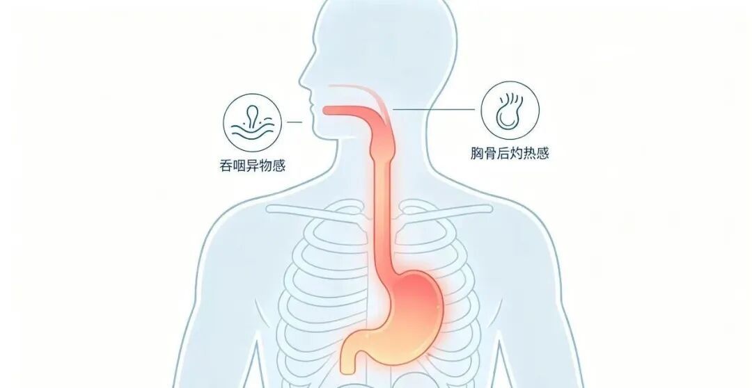 被“趁热吃”毁掉的食管！食道癌早期极易忽视，这些症状、诱因一定要懂