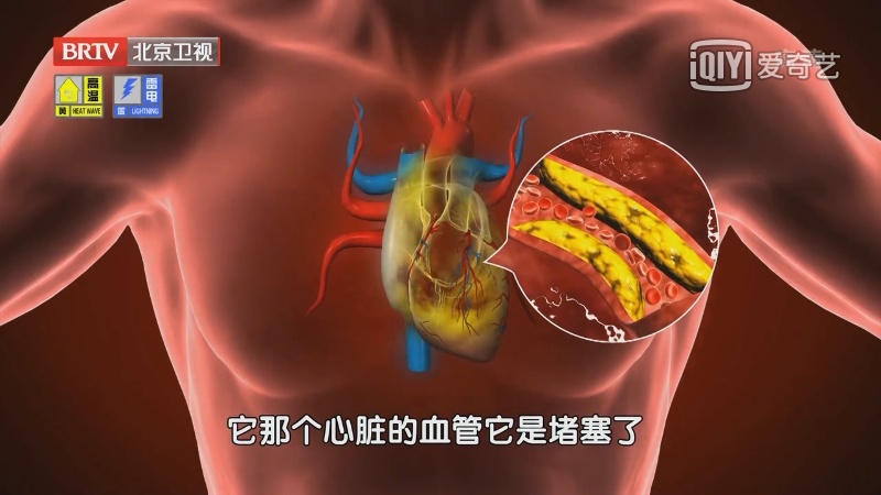 比胆固醇更危险?这个血脂指标偏高,心衰风险暴增77%,很多人都漏掉了 比胆固醇更危险?这个血脂指标偏高,心衰风险暴增77%,很多人都漏掉了