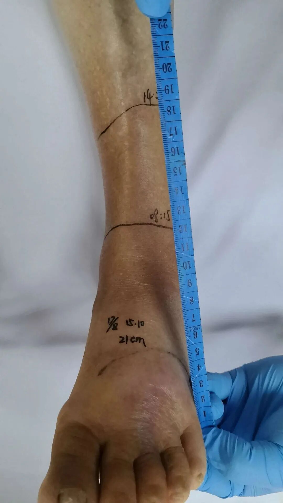 88岁奶奶在家门口遇到眼镜蛇,一脚踢过去反被蛇张口咬伤 88岁奶奶在家门口遇到眼镜蛇,一脚踢过去反被蛇张口咬伤
