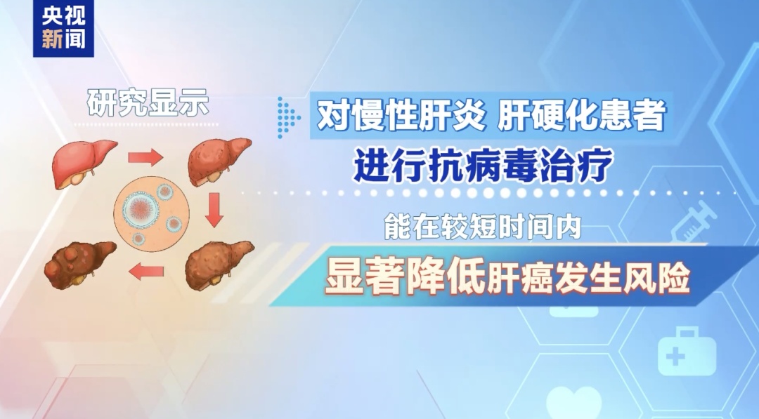 身体出现这几个信号，可能是肝在“求救”